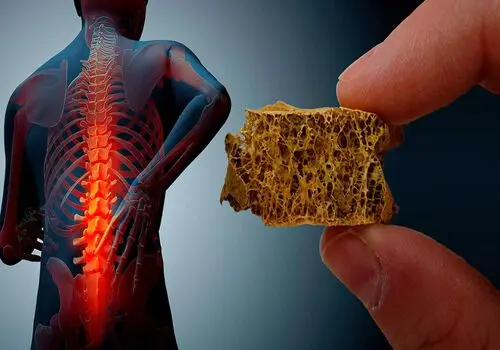 نقش مهم آجیل در جلوگیری از پوکی استخوان