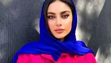تغییر چهره شگفت آور از ترلان پروانه