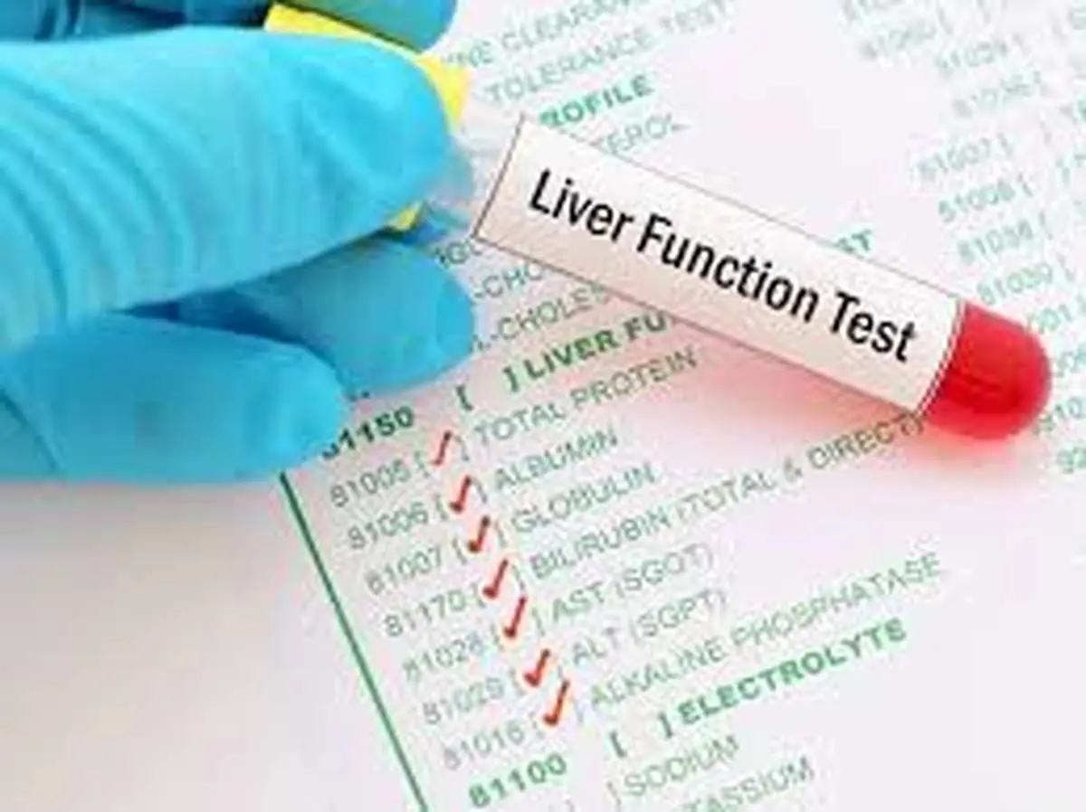 
برای تشخیص کبد چرب آزمایش بهتر است یا سونوگرافی؟
