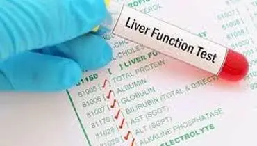 
برای تشخیص کبد چرب آزمایش بهتر است یا سونوگرافی؟
