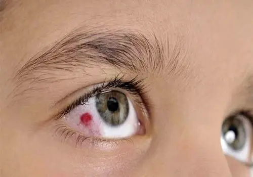  ۹ کاری که برای حفظ سلامت چشمتان هرگز نباید انجام دهید
