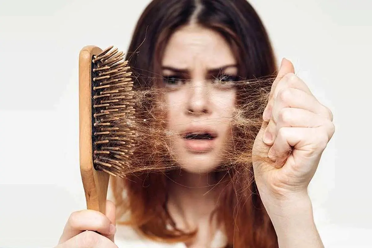 علت ریزش موی جلوی سر در زنان