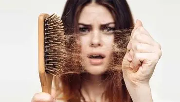 علت ریزش موی جلوی سر در زنان