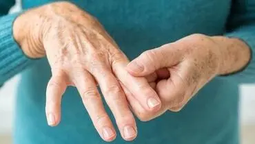 علل و عوامل پدید آمدن لرزش دست