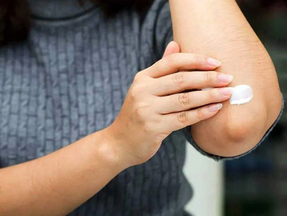 چرا پوست آرنج مستعد تیرگی است؟