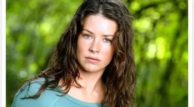 بازیگر «لاست» ضربه مغزی شد!