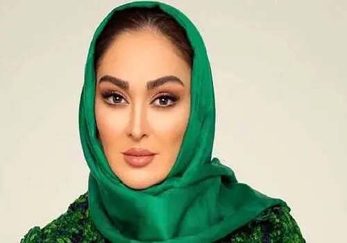 حمله زنبورها بازیگر سرشناس را به این روز انداخت! +عکس