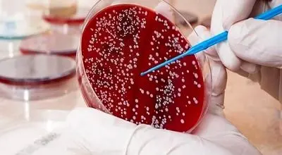 افزایش نگران‌کننده این بیماری مرتبط با روده در ایران
