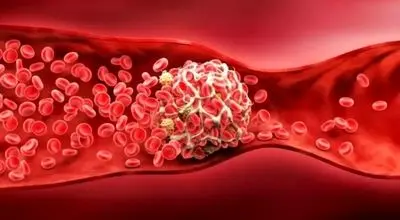 هشدار درباره کراتین؛ وقتی مکمل محبوب پای لخته خون را وسط می‌کشد