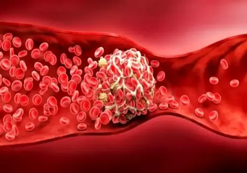 ویتامین B۶ زیر ذره‌بین؛ نکاتی که سلامتی‌تان را تحت تاثیر قرار می‌دهد