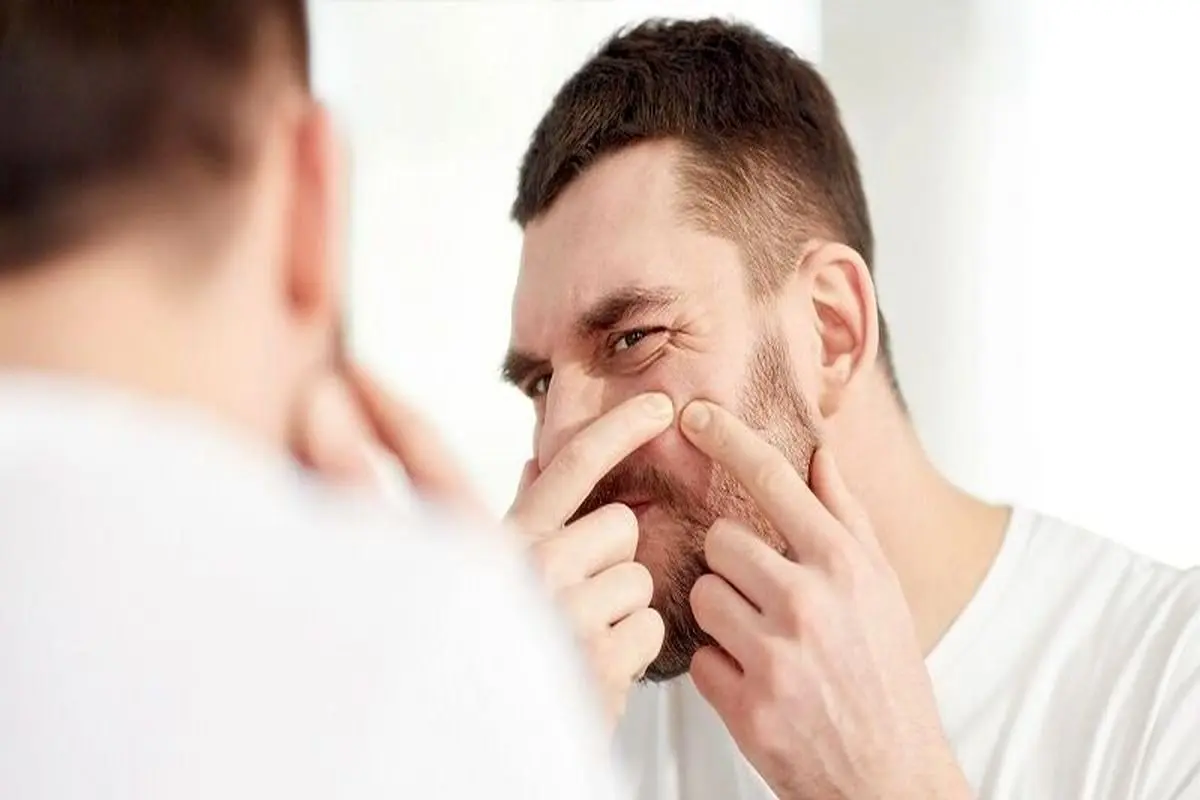 علت اصلی جوش چرکی چیست ؟