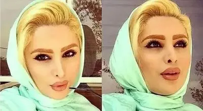 اپلیکیشن بله، کانال دنیا جهانبخت را بست