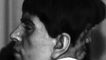 معمای مردی که در پشت سرش یک صورت عجیب داشت+ عکس
