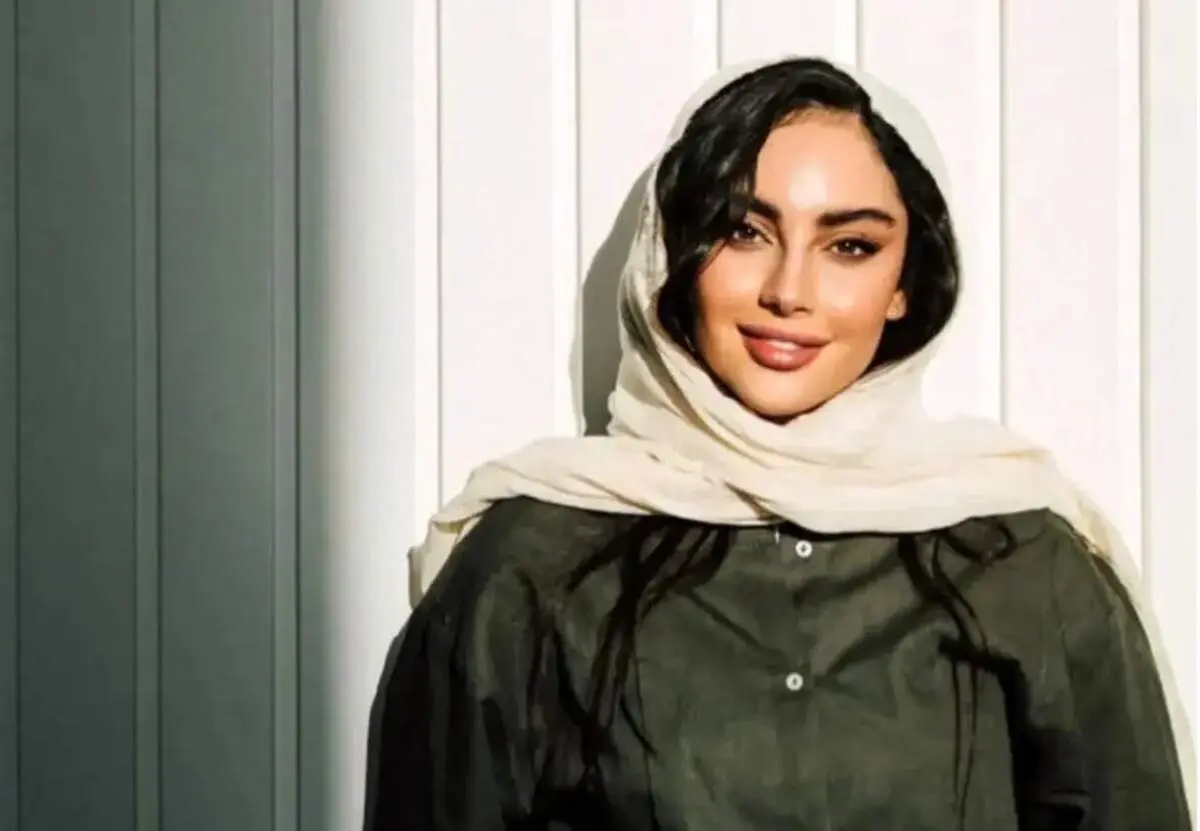 ترلان پروانه ظاهرش را شبیه هدیه تهرانی کرد!