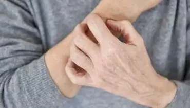 
خطاهای رایج پوستی در هوای سرد
