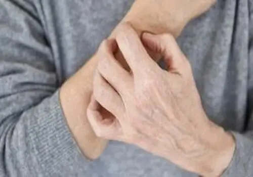 طلای سفید به چه پوستی می آید؟