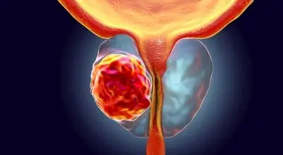 دولت صدای اعتراض بیماران صعب العلاج را بشنود
