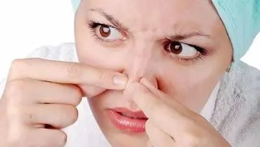 با این ترفند ساده، جوش‌های سرسیاه بینی را در خانه حذف کنید! 
