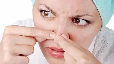 با این ترفند ساده، جوش‌های سرسیاه بینی را در خانه حذف کنید! 