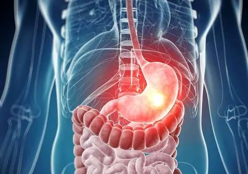 اثر ریفلاکس معده بر بروز اختلالات خواب
