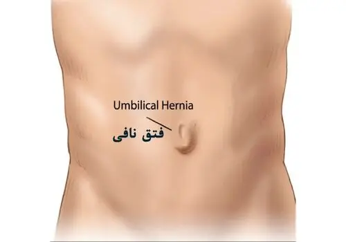 جراحی‌های خطرناک؛ بُکش و خوشگلم کن