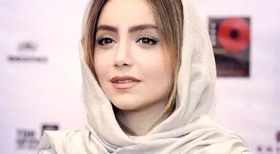 تغییر چهره نازنین بیاتی وجراحی‌هایی که انجام داده+عکس