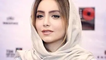 تغییر چهره نازنین بیاتی وجراحی‌هایی که انجام داده+عکس