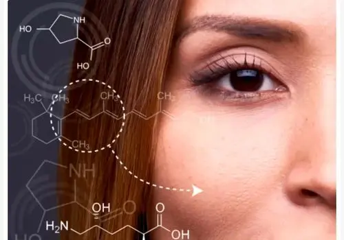 کدام نشانه پوستی  نشانه بیماری صفرایی است؟ 