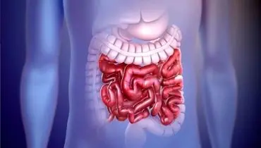 تضمین سلامت روده با این عوامل