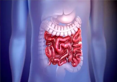 تحقیق درباره ی بیش فعالی (ADHD) و عوامل ایجادکننده ی آن
