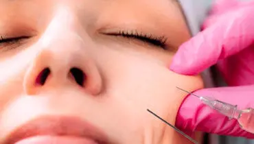 هشدار درباره مصرف ژل‌های تزریقی زیبایی