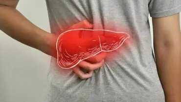 آیا افراد لاغر هم به «کبد چرب» مبتلا می‌شوند؟