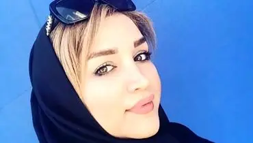 استوری دندان شکن خواهر پژمان جمشیدی +عکس