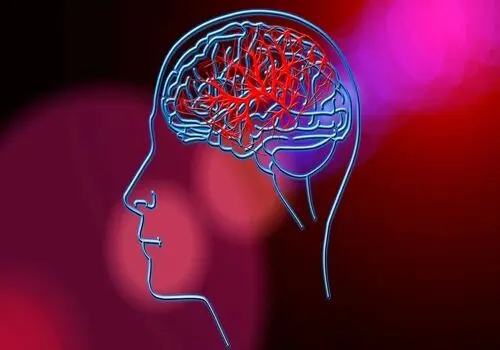 راهکار جدید تشخیص سکته مغزی
