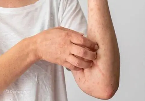 در شرایط اشعه فرابنفش چگونه ورزش کنیم؟

