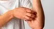 در مواجهه با اشعه فرابنفش چه کنیم؟

