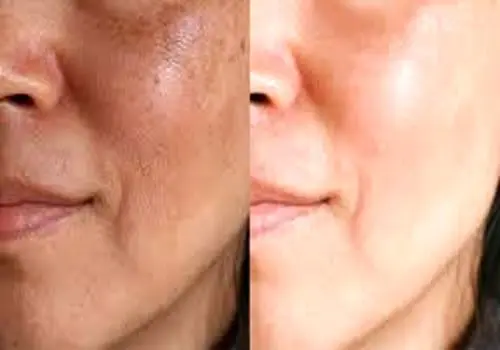 در هر شرایطی فعالیت مراکز درمانی متوقف نخواهد شد
