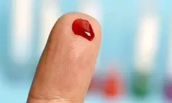  گروه خونی ۹۰ درصد ایرانیان مثبت است