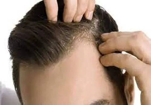 طرز استفاده گلاب برای تقویت مو