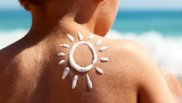 آفتاب‌سوختگی را با این روش فورا درمان کنید