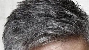 اگر موهایتان زود سفید می‌شود، این نکات را بدانید