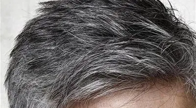 اگر موهایتان زود سفید می‌شود، این نکات را بدانید