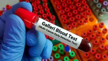 آزمایش خون Galleri؛ گامی نو در تشخیص سرطان‌های فاقد برنامه غربالگری