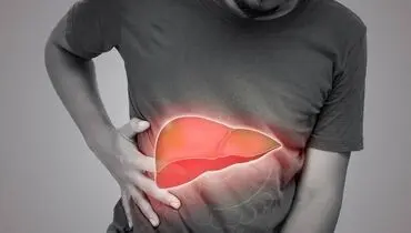 نقش فعالیت بدنی در کاهش خطرات کبد چرب