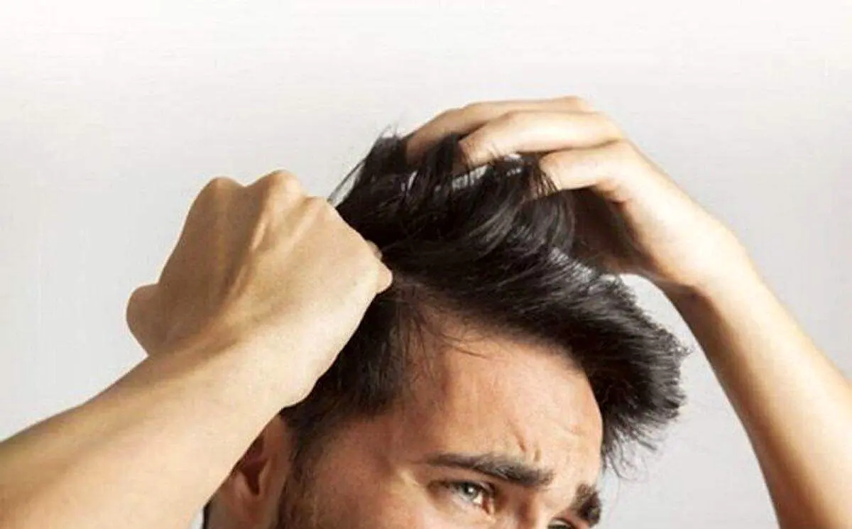 خارش سر کمبود چه ویتامینی است؟