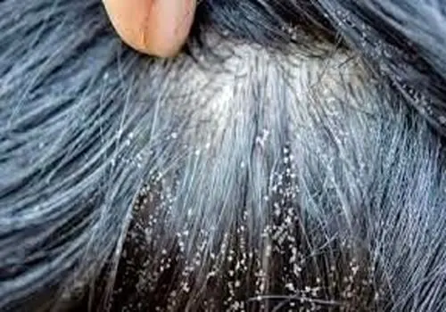  انواع اختلال یادگیری در کودکان چیست؟