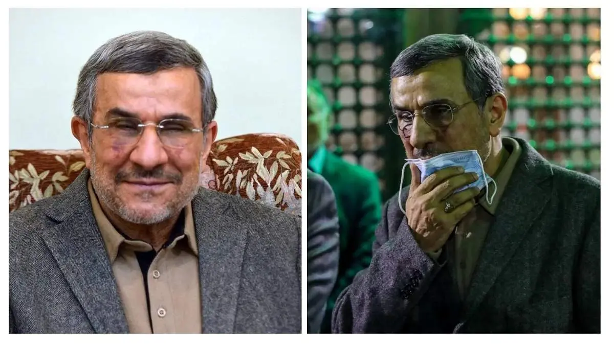 دلیل کبودی و ورم صورت احمدینژاد فاش شد