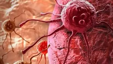 غربالگری کدام سرطان‌ها اولویت دارد؟
