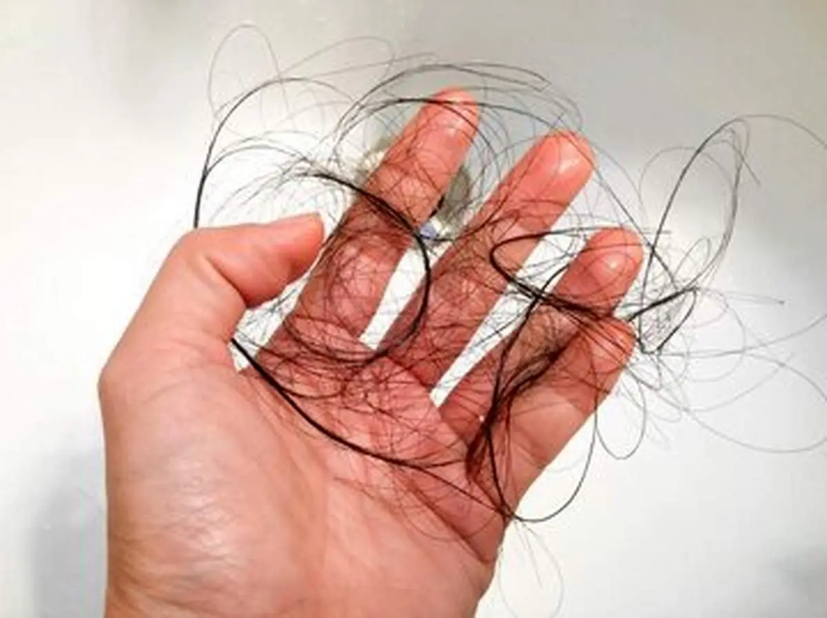۲۰ خوراکی برای جلوگیری از ریزش مو