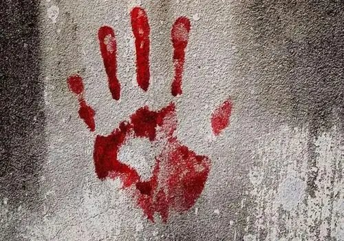 حمله سگ‌های ولگرد به کودک 11 ساله؛ امیرعلی جان خود را از دست داد